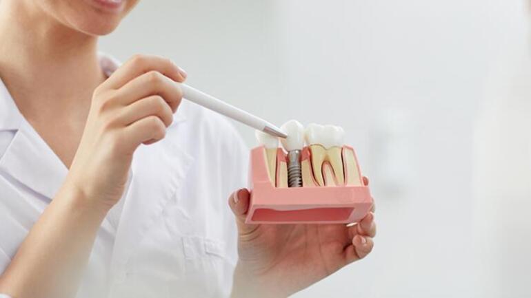 Bu maddeye dikkat Dişleri beyazlatmak yerine zarar veriyor