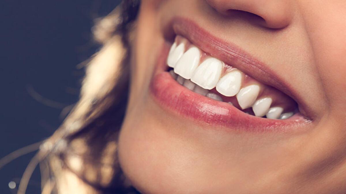 Diş estetiğinin ağız sağlığına faydaları