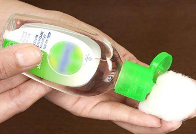 Uçuğa ne iyi gelir, nasıl geçer Uçuğu ne geçirir Uçuğu evde geçiren doğal yöntemler