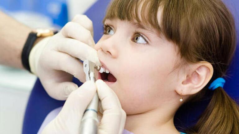 Çocukları süt dişi çürüklerinden korumak için 5 öneri
