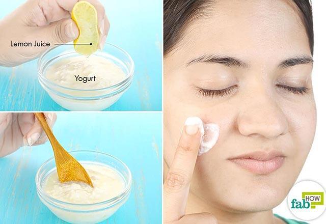 Sivilce nasıl geçer, ne iyi gelir Yüzdeki sivilce izlerine evde bitkisel çözüm önerileri