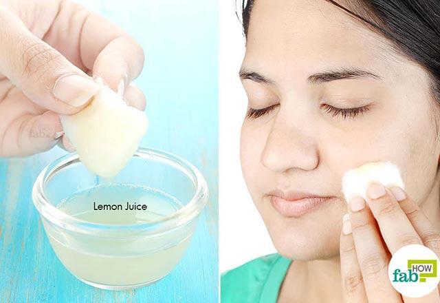 Sivilce nasıl geçer, ne iyi gelir Yüzdeki sivilce izlerine evde bitkisel çözüm önerileri