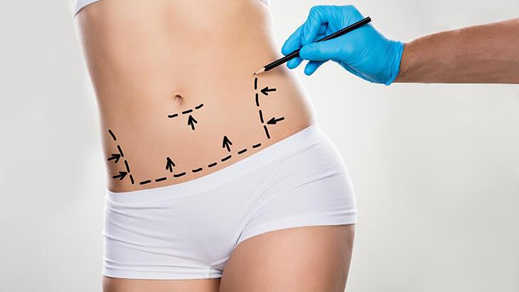 Liposuction sonrasında iyileşme süreci nasıl olmalı?