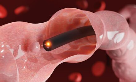 Kolon polipleri ve kolonoskopi hakkında doğru sanılan 5 yanlış