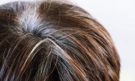 ‘Genetiktir’ deyip geçmeyin… Saçlarınız beyazlıyorsa vücudunuz sinyal veriyor olabilir! Saç beyazlamasına bunlar neden oluyor