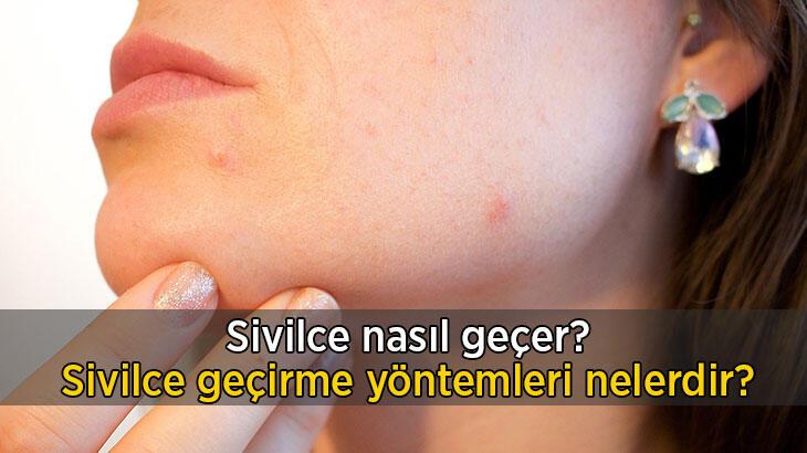 Kötü görünen sivilcelerden en hızlı ve en basit yöntemlerle kurtulmanız mümkün!