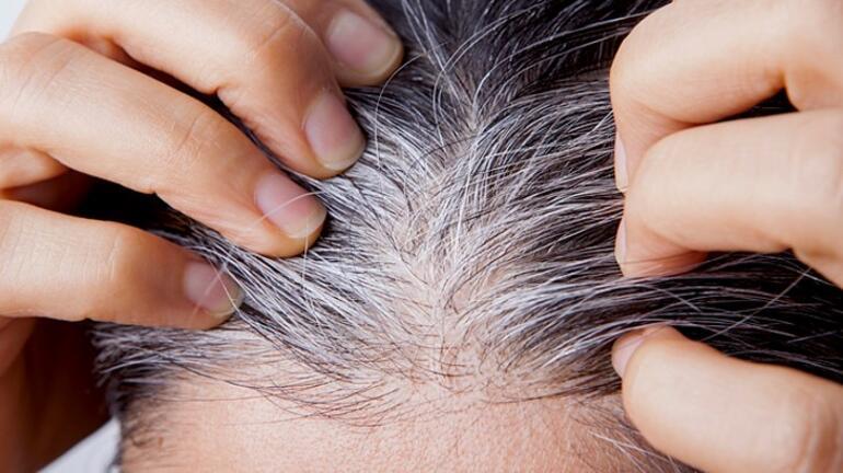 ‘Genetiktir’ deyip geçmeyin… Saçlarınız beyazlıyorsa vücudunuz sinyal veriyor olabilir Saç beyazlamasına bunlar neden oluyor