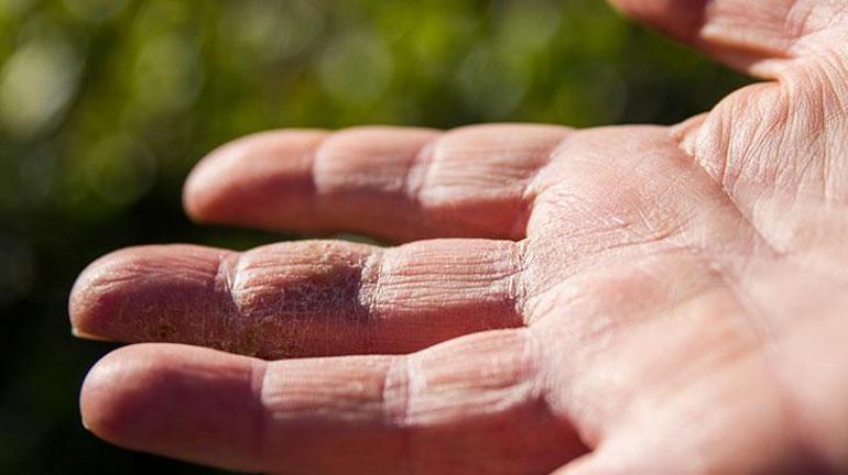 Çatlak ve kuru ellerin dostu Sürünce elleri anında pamuk gibi yapıyor