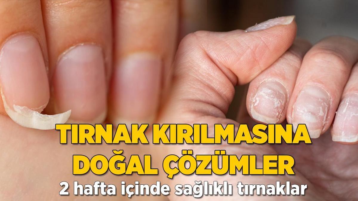 Tırnaklarınız hemen kırılıyorsa çaresi belli! Yumurta sarısı tüm sorunu çözüyor