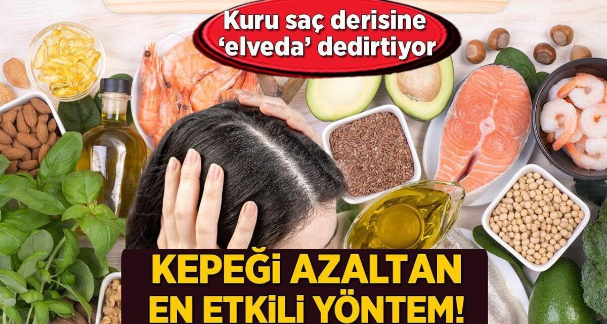 Kepeği azaltan en etkili yöntem! Kuru saç derisine 'elveda' dedirten beslenme mucizesi