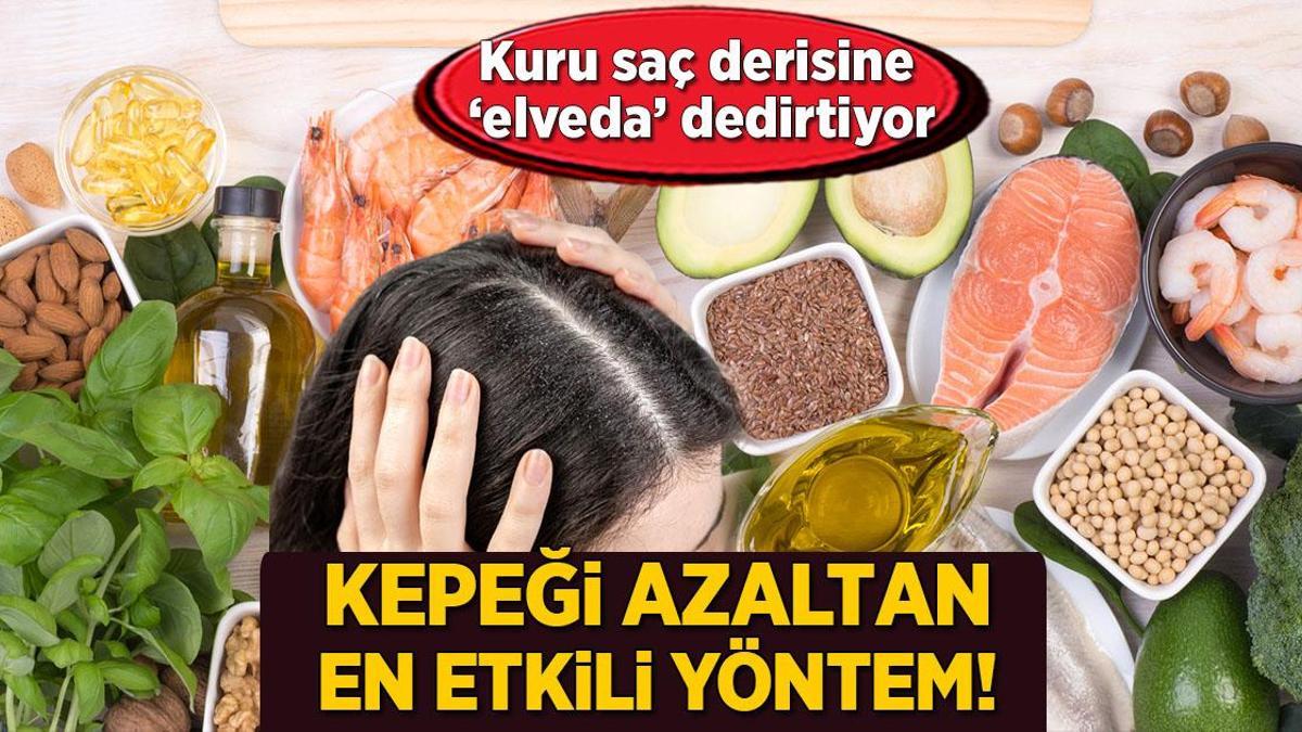 Kepeği azaltan en etkili yöntem! Kuru saç derisine 'elveda' dedirten beslenme mucizesi