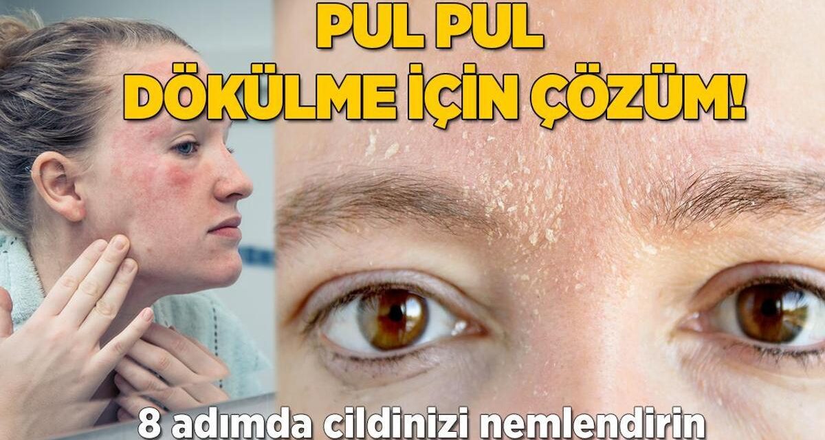 Cildi pul pul dökülenlere 'oh' dedirten tavsiye! Biraz ceviz biraz keten tohumu yetiyor