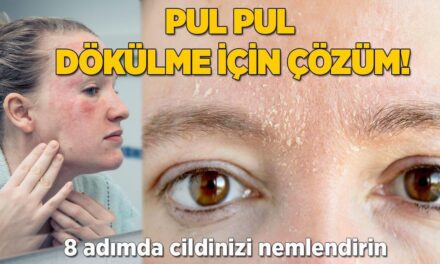 Cildi pul pul dökülenlere 'oh' dedirten tavsiye! Biraz ceviz biraz keten tohumu yetiyor