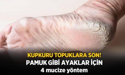 Kupkuru, çatır çatır çatlamış topuklara son! Pamuk gibi ayakların sırrı bu yöntemde saklı
