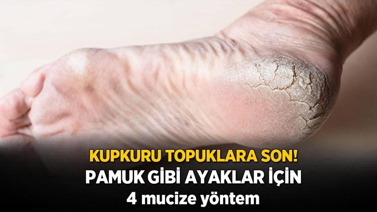 Kupkuru, çatır çatır çatlamış topuklara son! Pamuk gibi ayakların sırrı bu yöntemde saklı
