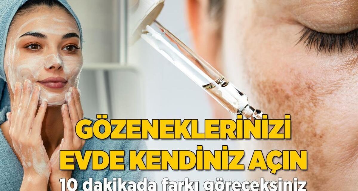 Yüzdeki yağ lekelerinden kurtulun! Kömür maskesi tüm gözenekleri açıyor