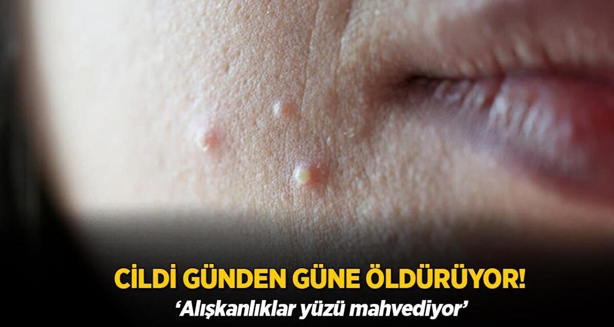 Cildi günden güne öldürüyor! Alışkanlıklar yüzü mahvediyor