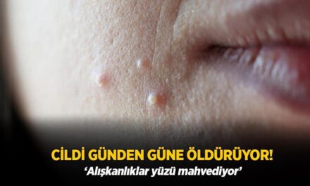 Cildi günden güne öldürüyor! Alışkanlıklar yüzü mahvediyor