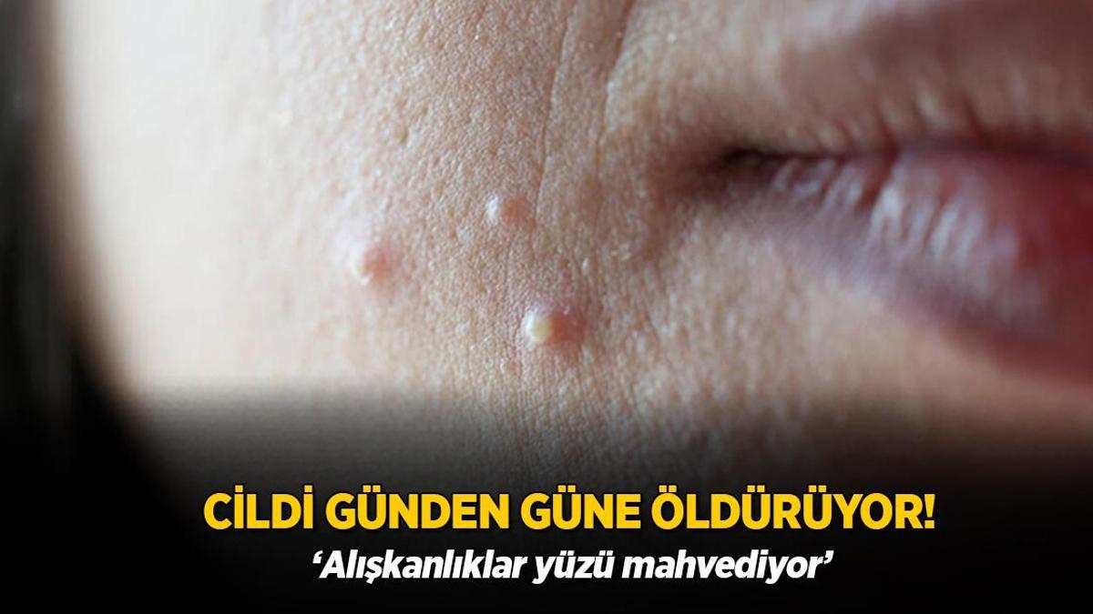 Cildi günden güne öldürüyor! Alışkanlıklar yüzü mahvediyor