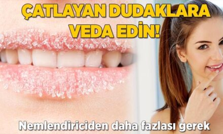 Nemlendiriciden daha fazlası gerekli! Çatlayıp yarılan dudaklar için bal-şeker formülü