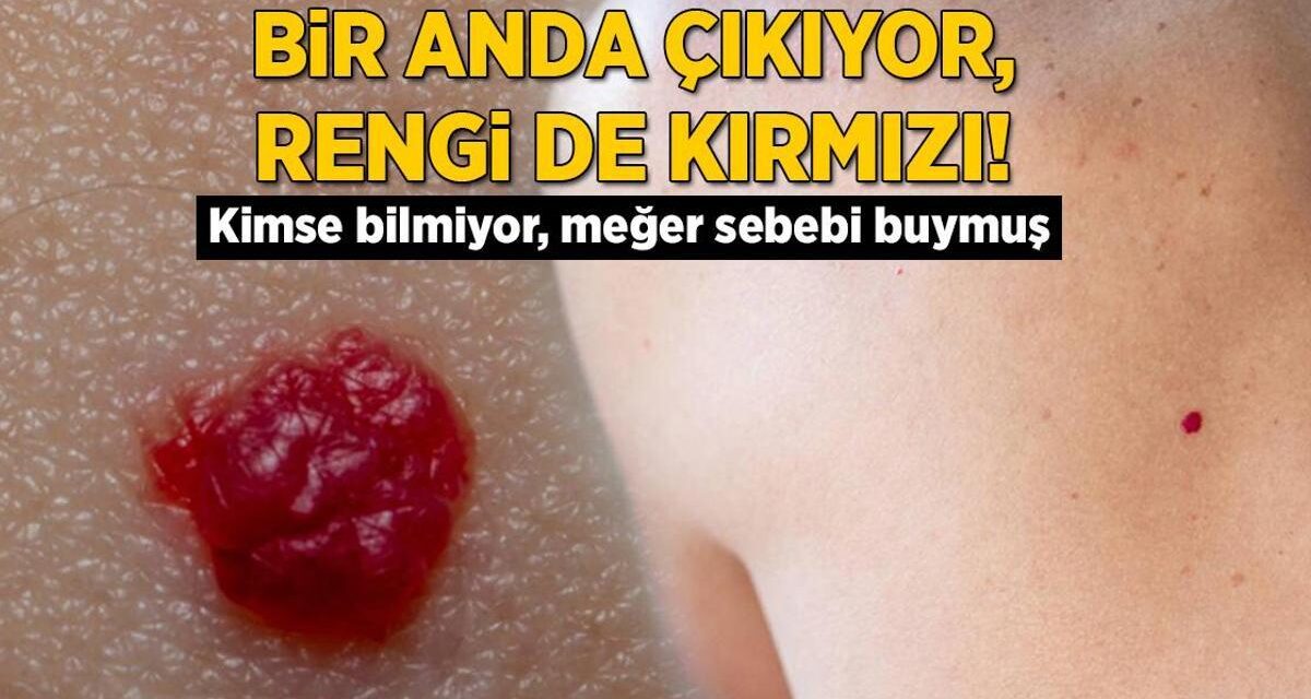 Ciltte bir anda çıkıyor, rengi de kırmızı! Kimse bilmiyor ama meğer sebebi buymuş