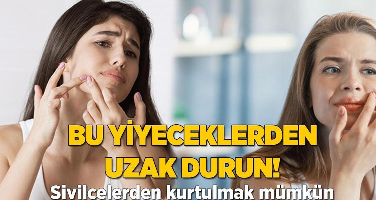 Bu yiyeceklerden uzak durun! Sivilcelerden kurtulmak mümkün