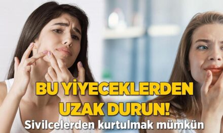 Bu yiyeceklerden uzak durun! Sivilcelerden kurtulmak mümkün