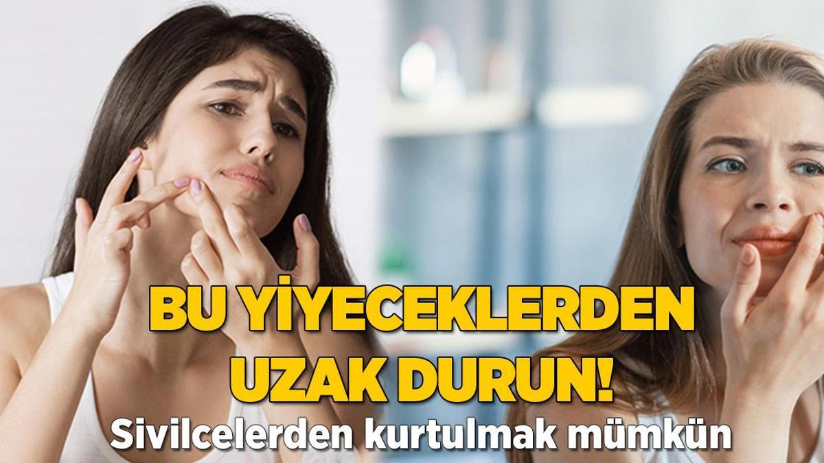 Bu yiyeceklerden uzak durun! Sivilcelerden kurtulmak mümkün