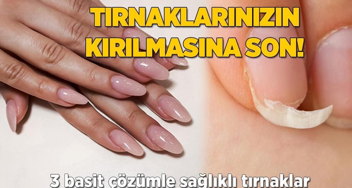 Sürekli oje sürünce yıpranıyor! Çatlak tırnakları güçlendiren 3 pratik çözüm