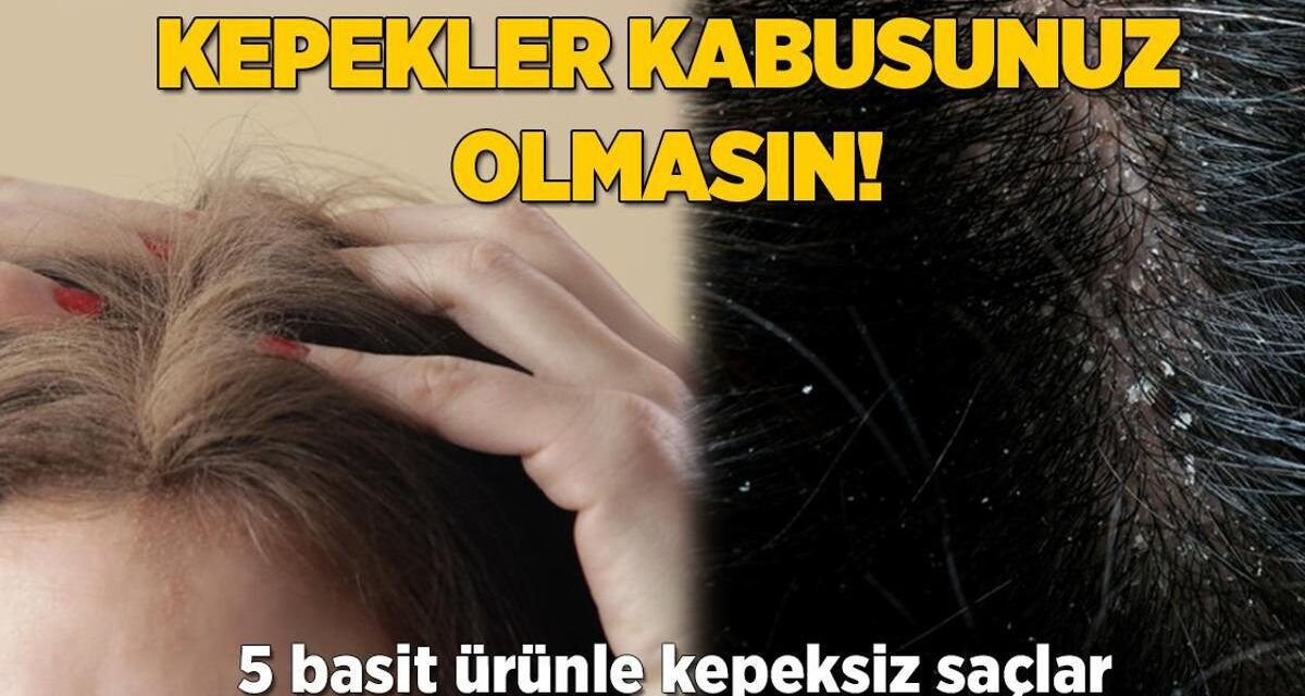 Kepekler kabusunuz olmasın! Hindistan cevizi yağının inanılmaz etkisi