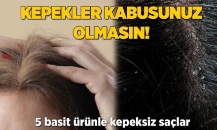 Kepekler kabusunuz olmasın! Hindistan cevizi yağının inanılmaz etkisi