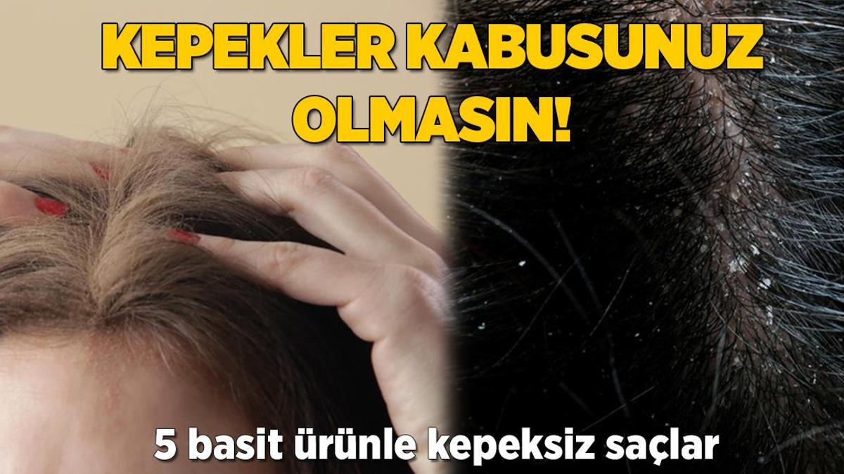 Kepekler kabusunuz olmasın! Hindistan cevizi yağının inanılmaz etkisi