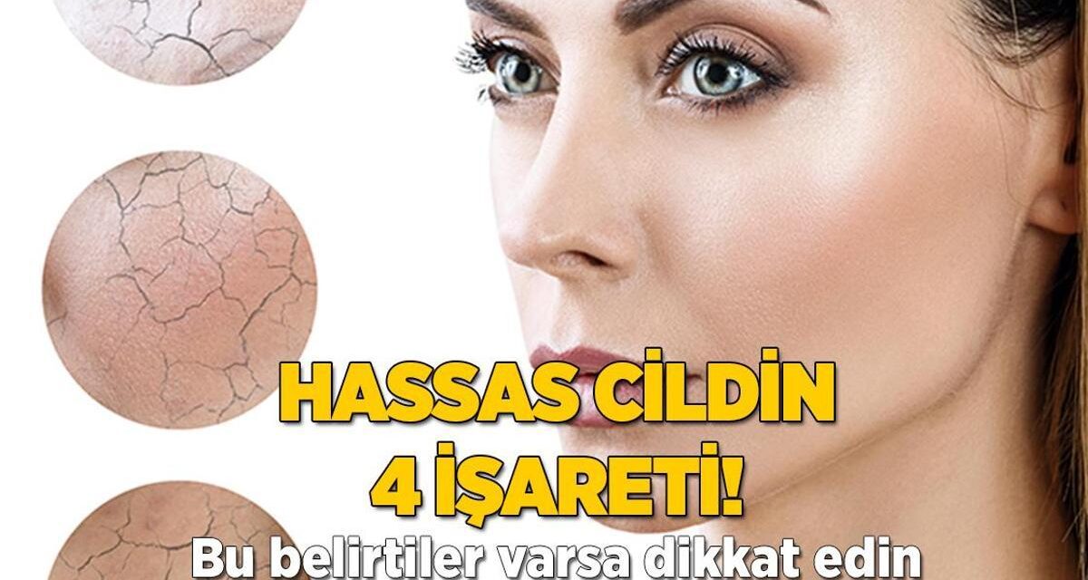 Bu belirtilere dikkat! Cildinizin hassas olduğunu gösteriyor