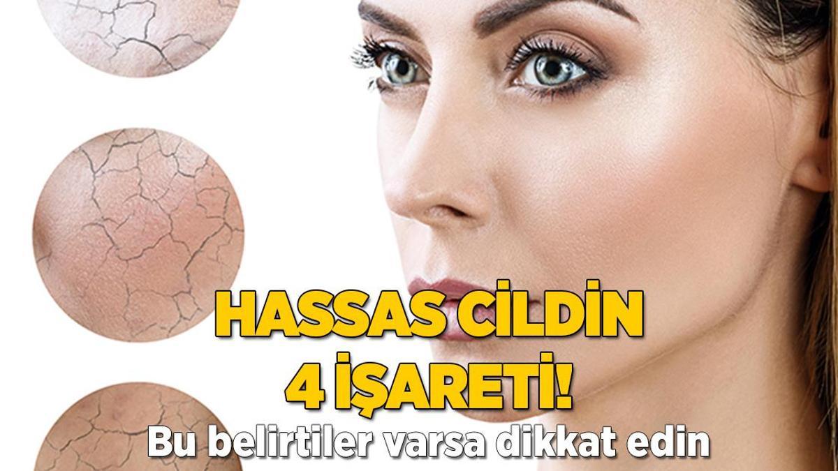 Bu belirtilere dikkat! Cildinizin hassas olduğunu gösteriyor