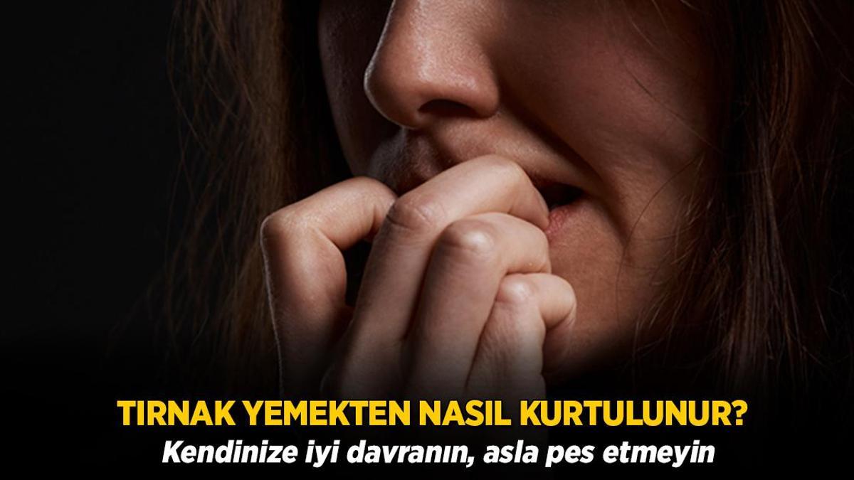 Tırnak yeme alışkanlığı nasıl bırakılır? Kendinize iyi davranın, asla pes etmeyin