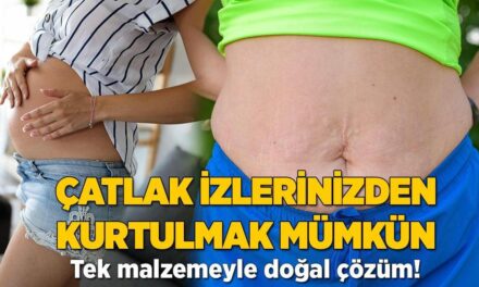 Çatlak izlerinizden kurtulmak mümkün! Tek malzemeyle doğal çözüm