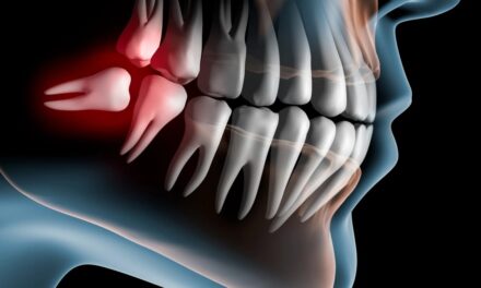 Başımızın belası: Neden 20’lik dişimiz var?