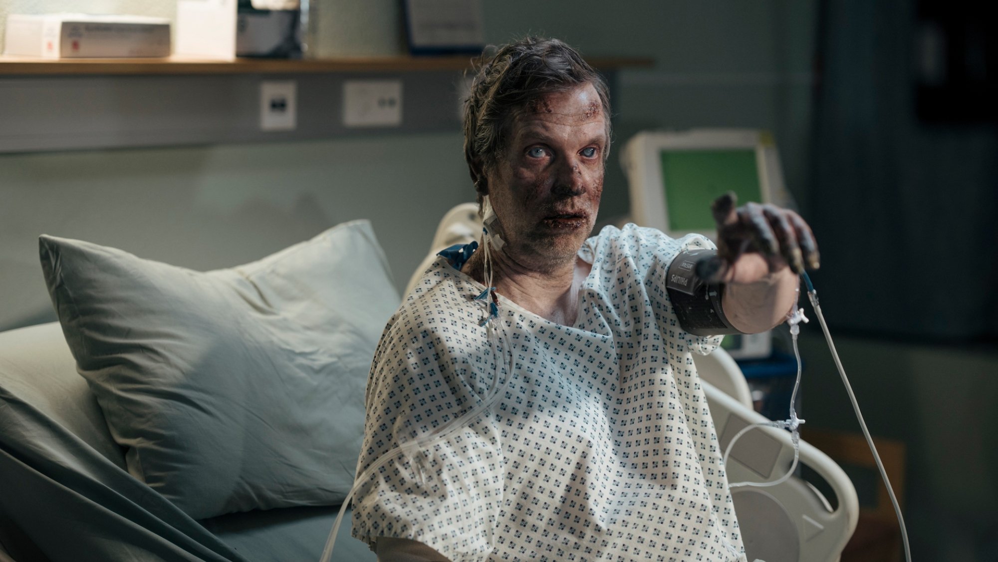 A man in hospital with severe frostbite looks threatening while pointing at the camera.