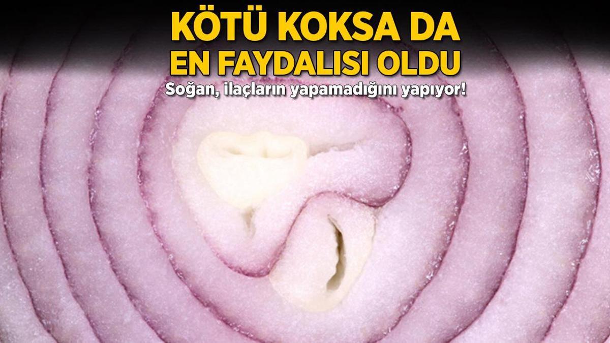 Kötü koksa da en faydalısı oldu! Soğan, ilaçların yapamadığını yapıyor