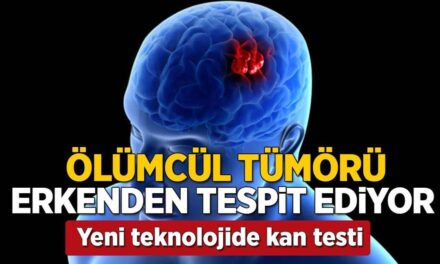 Ölümcül tümöre erkenden teşhis! Yeni çıkan 'kan testi' her şeyi değiştirebilir
