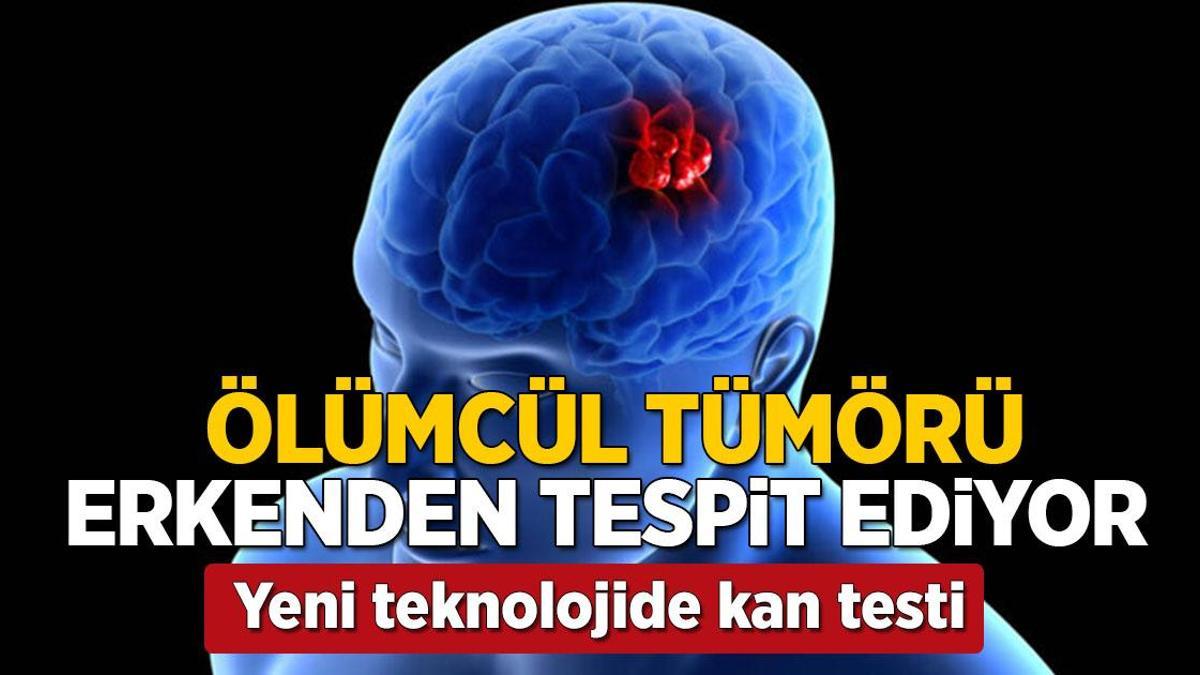 Ölümcül tümöre erkenden teşhis! Yeni çıkan 'kan testi' her şeyi değiştirebilir