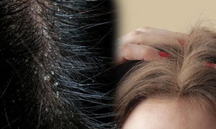 Kepeksiz saçlar için doğal formül var! Kurtulmanın yolu ılık suda saklı