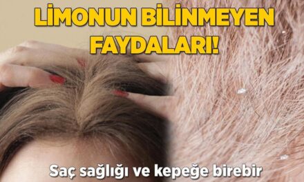 Limonun bilinmeyen faydaları! Saç sağlığı ve kepeğe birebir