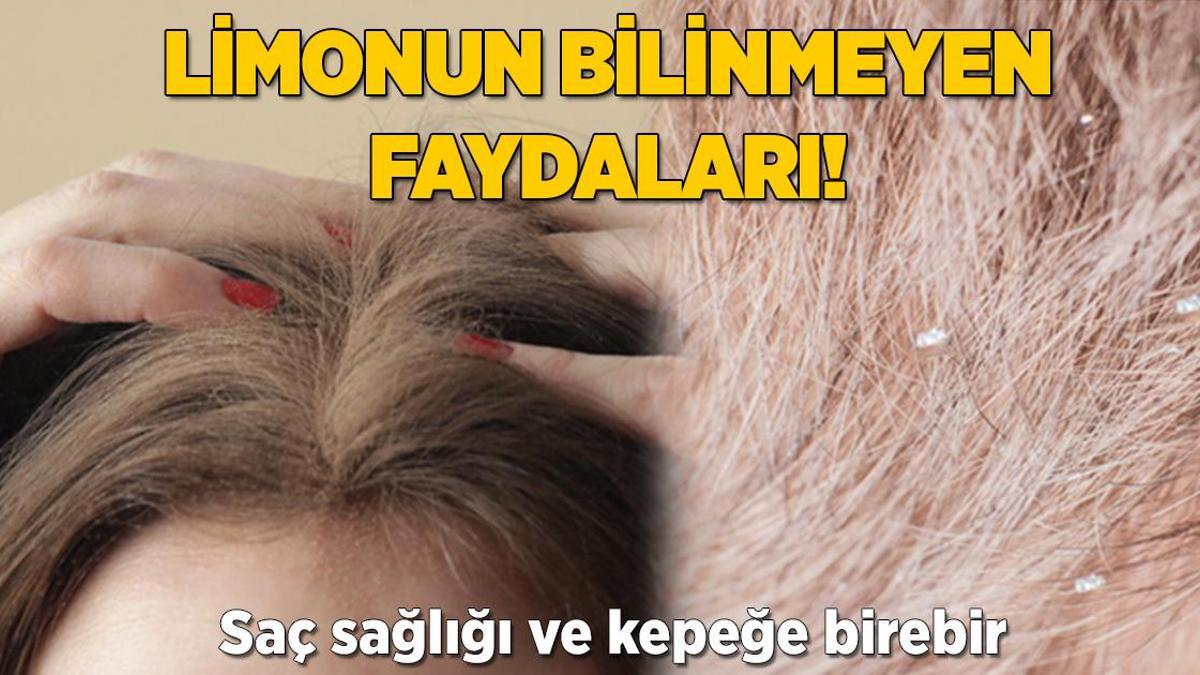 Limonun bilinmeyen faydaları! Saç sağlığı ve kepeğe birebir