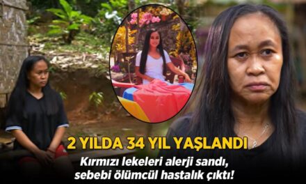 2 senede 34 yıl yaşlandı! Kırmızı lekeleri alerji sandı, sebebi ölümcül çıktı