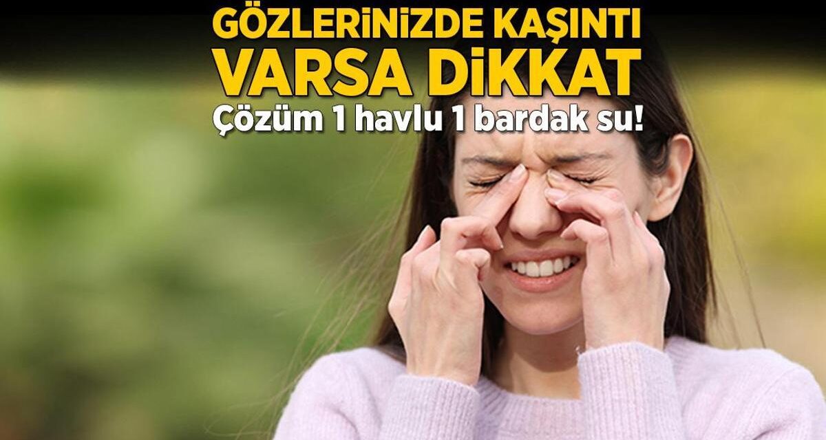 Gözlerinizde kaşıntı varsa dikkat! Çözüm 1 havlu, 1 bardak su