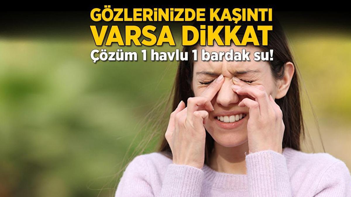 Gözlerinizde kaşıntı varsa dikkat! Çözüm 1 havlu, 1 bardak su