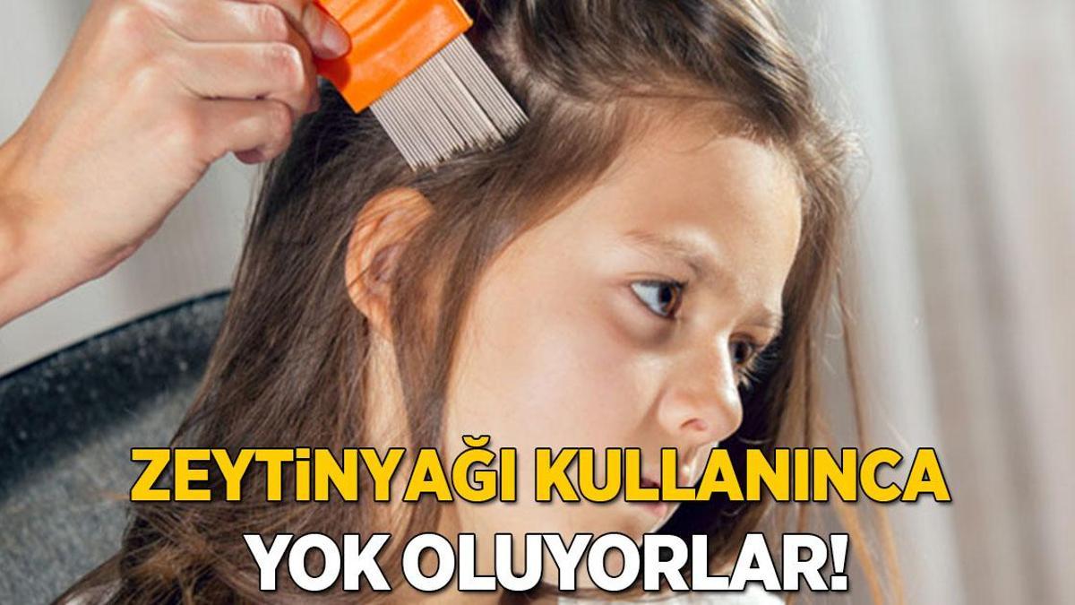 Saç bitinden arındıran en doğal yöntem! Her evde var, yapınca boğarak öldürüyor