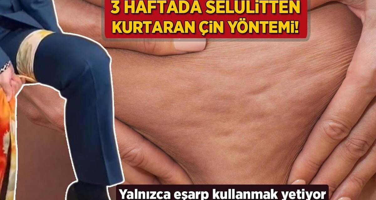 3 haftada selülitten kurtaran Çin yöntemi! Yalnızca eşarp kullanmak yetiyor