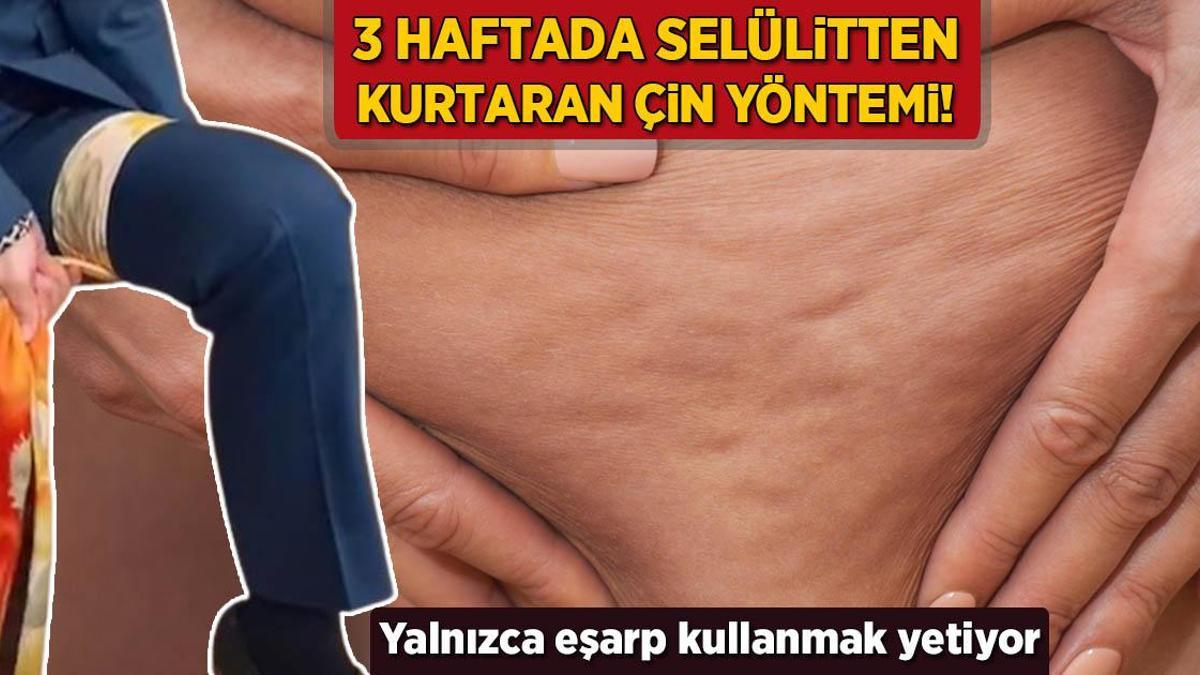 3 haftada selülitten kurtaran Çin yöntemi! Yalnızca eşarp kullanmak yetiyor
